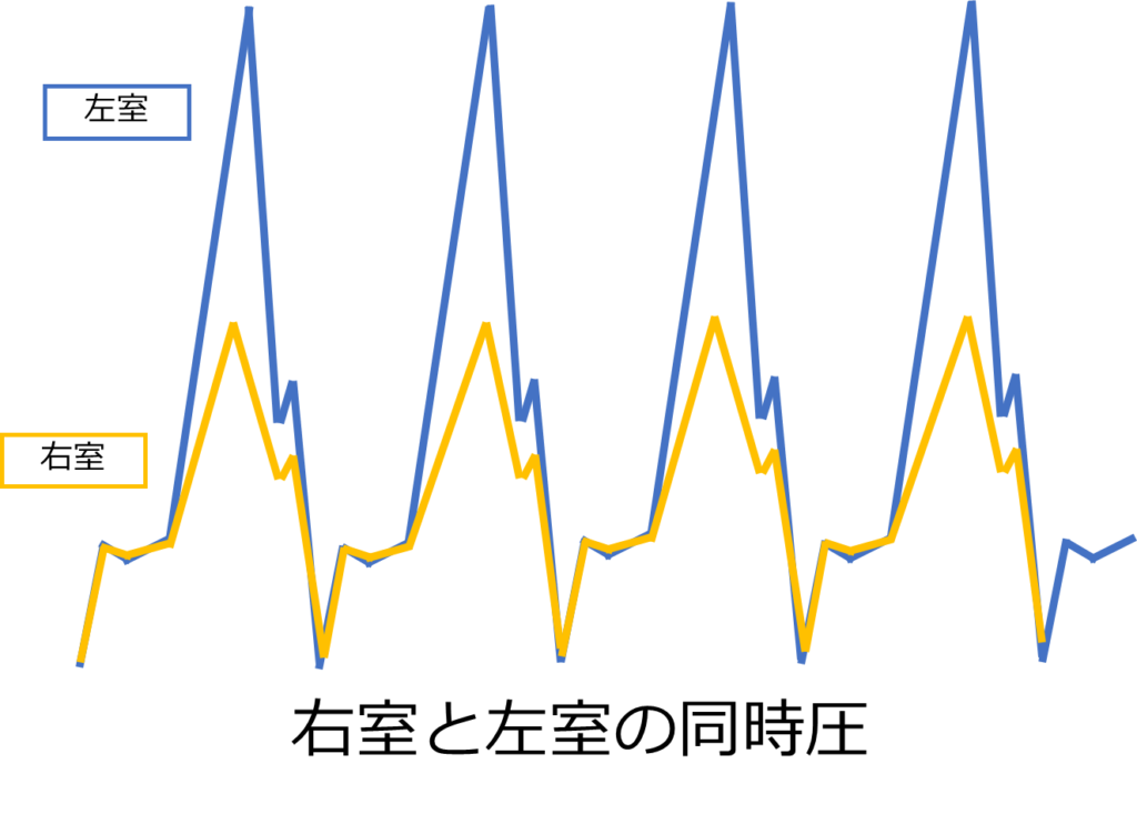 収縮性心膜炎はどのように診断されますか?