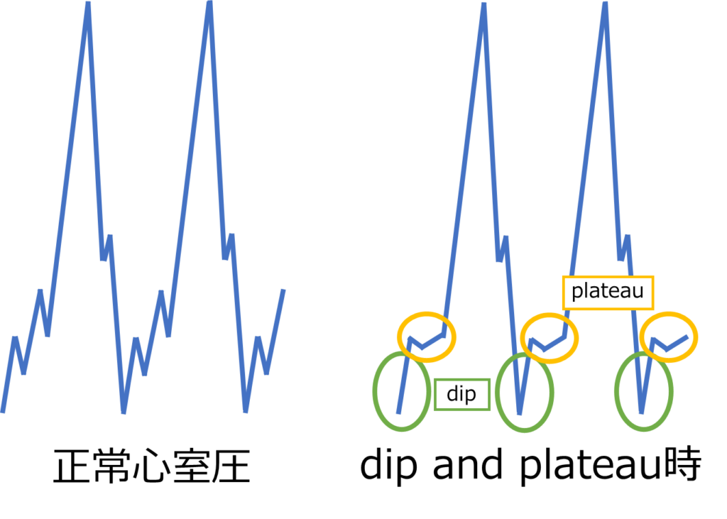 治療の選択肢は何ですか?